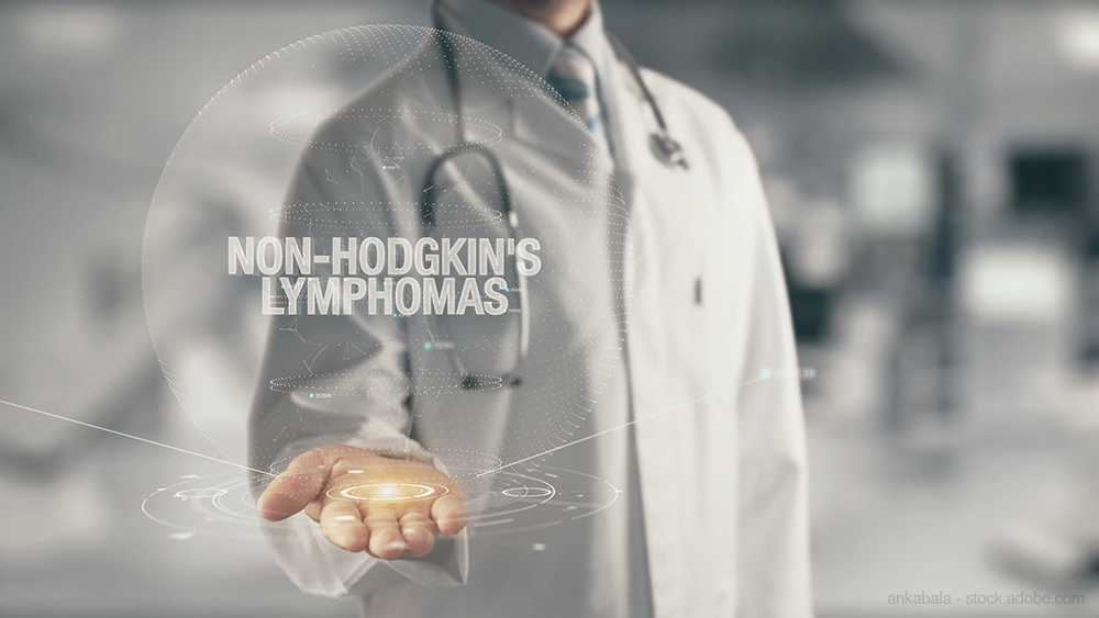 Non hodkin's lymphomas