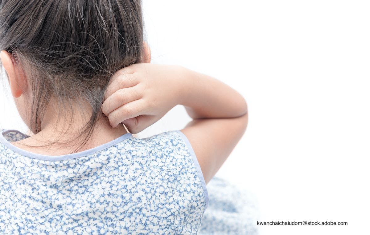 What's Coming for Pediatric Atopic Dermatitis