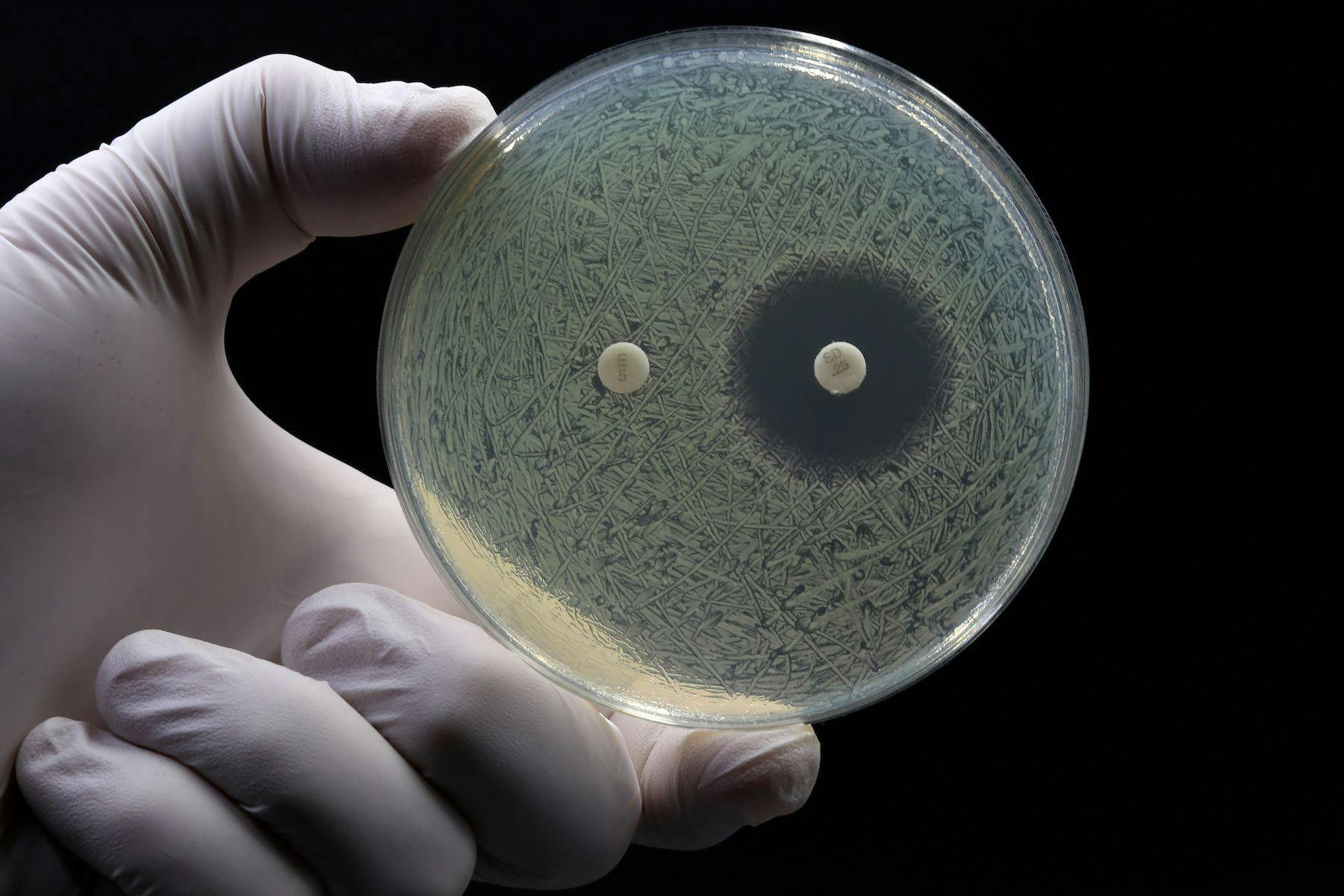 Examining Antibiotic Allergies, Pharmacists Role in Testing