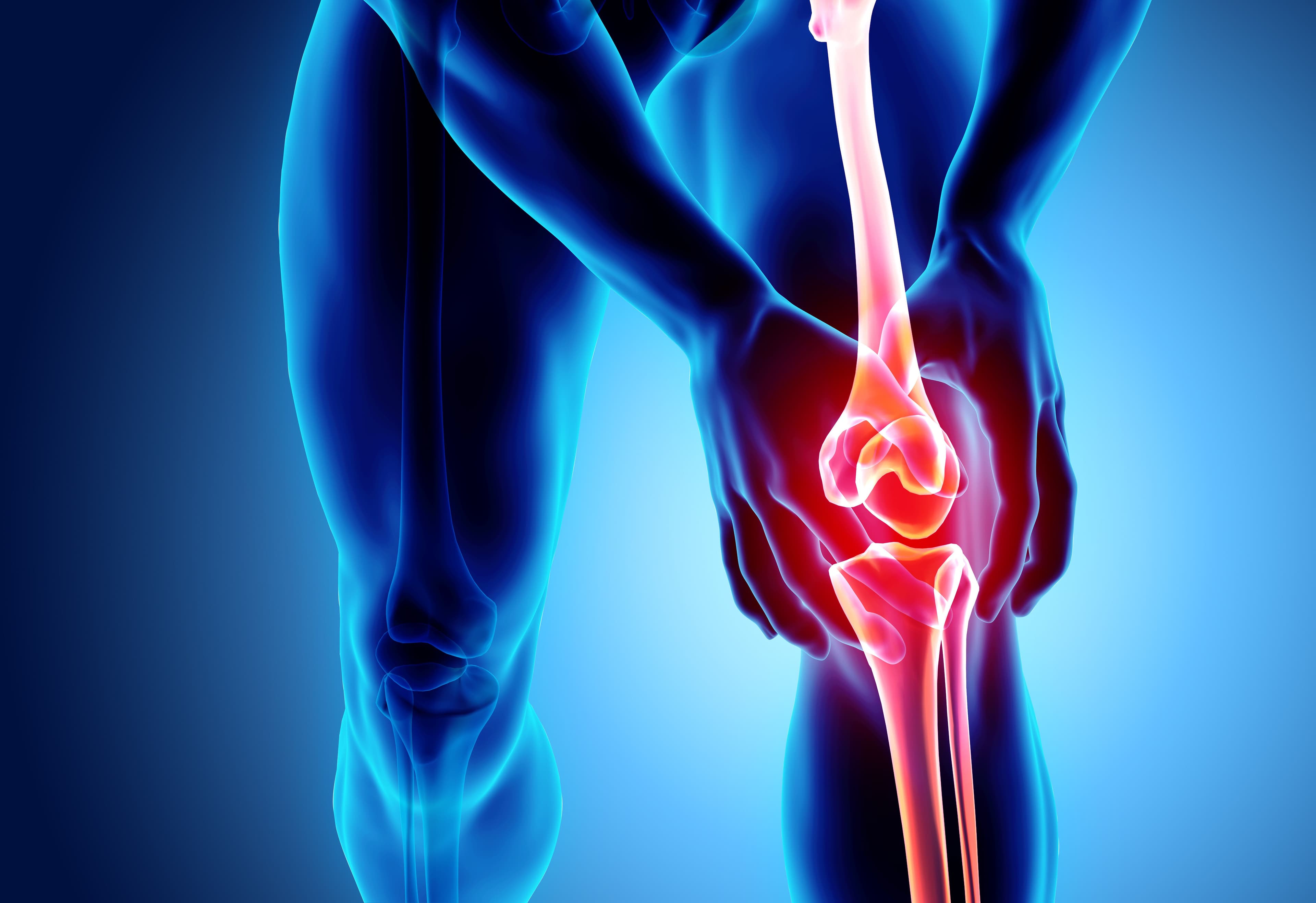 Weekly Semaglutide Injection Reduces Knee Osteoarthritis Pain