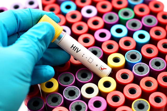 Lenacapavir for PrEP Shows 100% Efficacy in Preventing HIV 