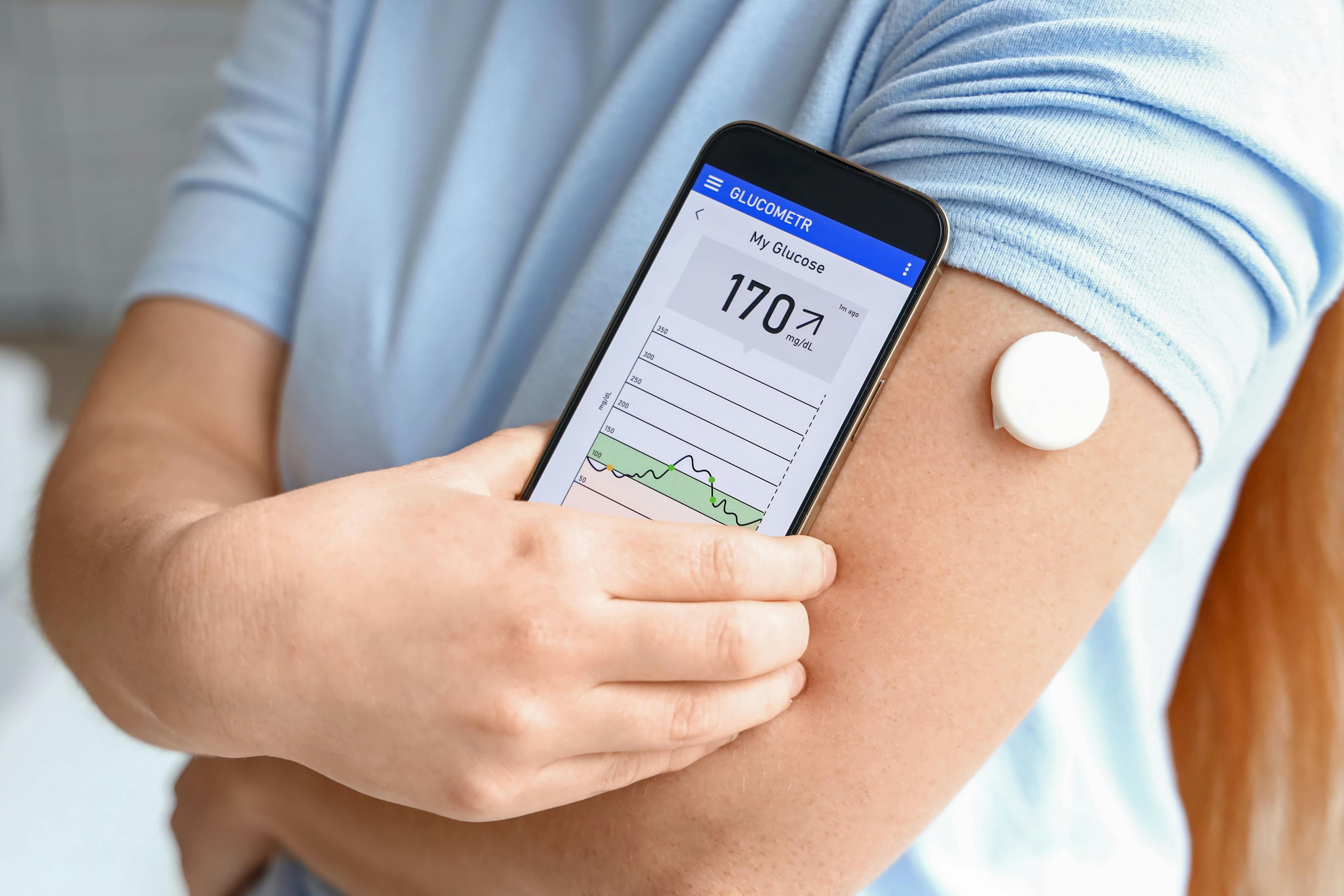 Continuous Glucose Monitors Help Reduce A1c in Patients with Diabetes / Pixel-Shot - stock.adobe.com