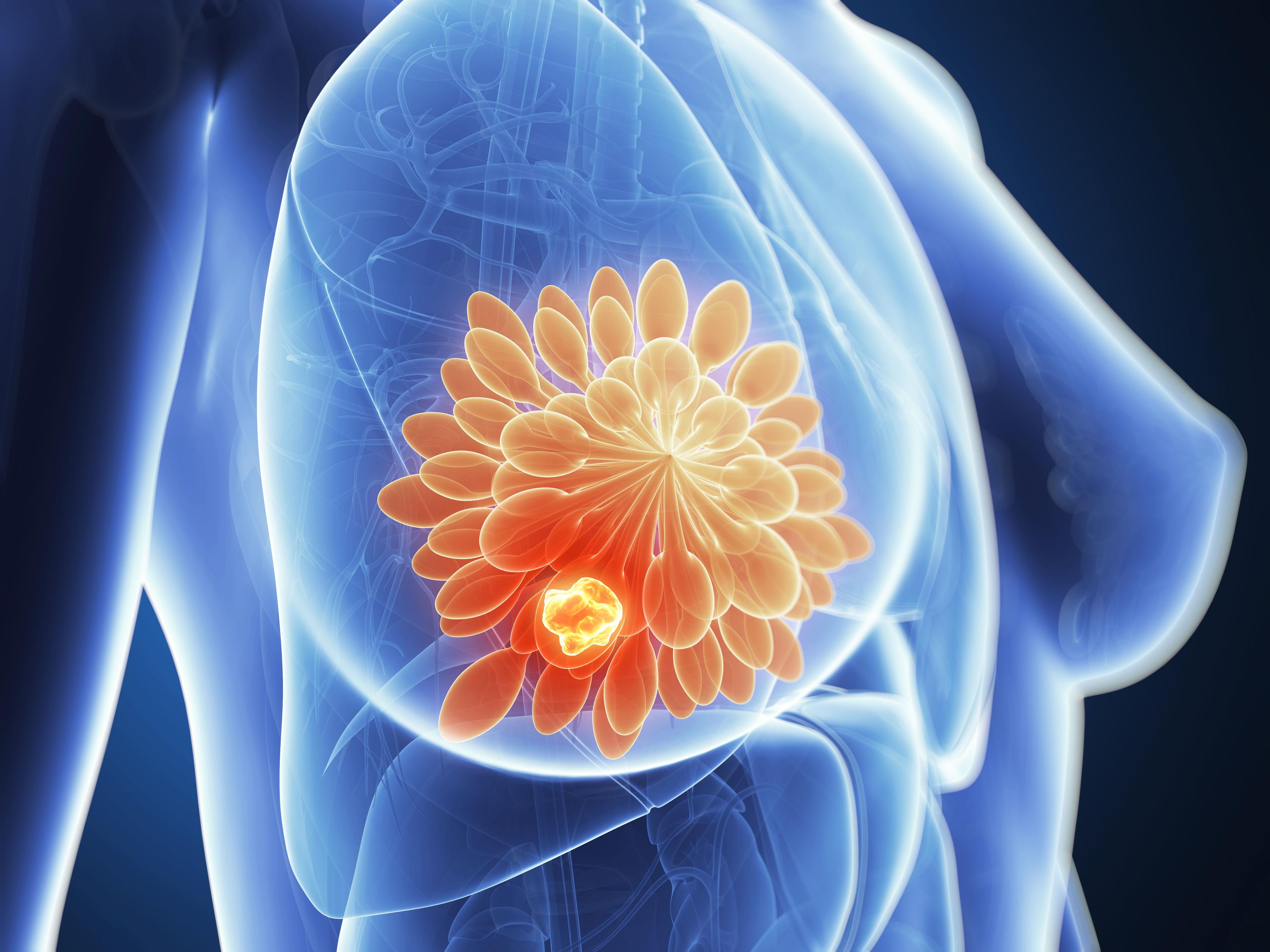 Ribociclib Plus Aromatase Inhibitor Approved as Adjuvant Therapy for HR+/HER2- Early Breast Cancer