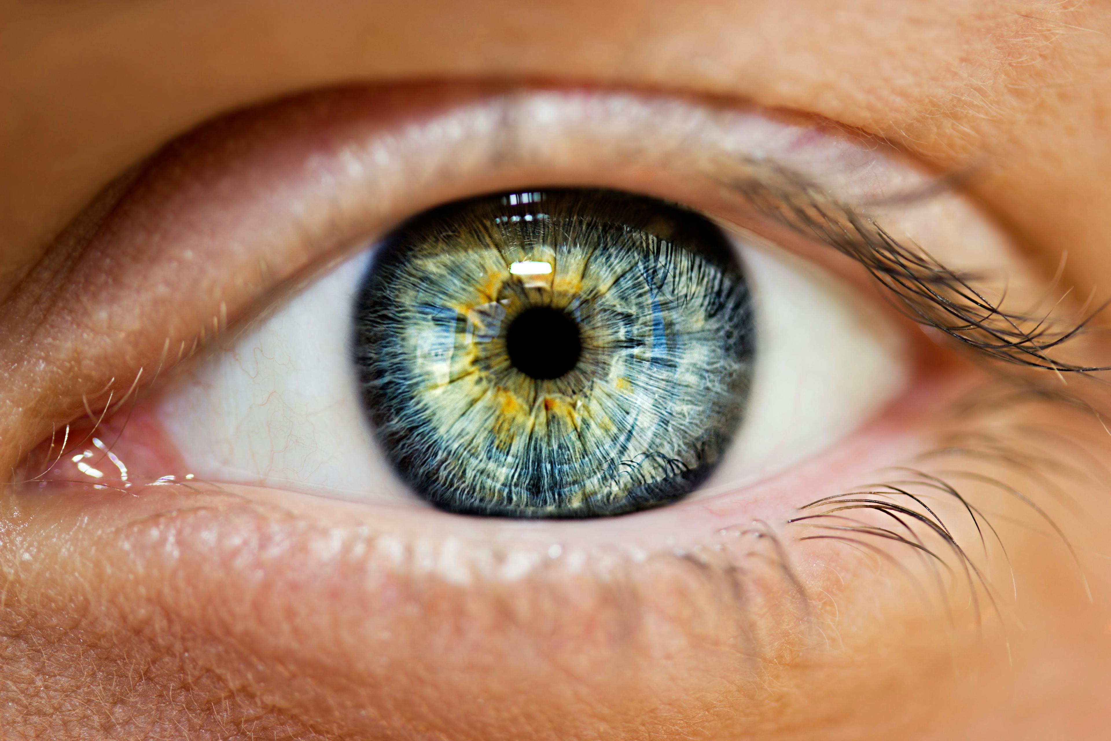 Aflibercept biosimilars are approved to treat wet AMD, diabetic macular edema, and diabetic retinopathy. | image credit: Victoria Key - stock.adobe.com