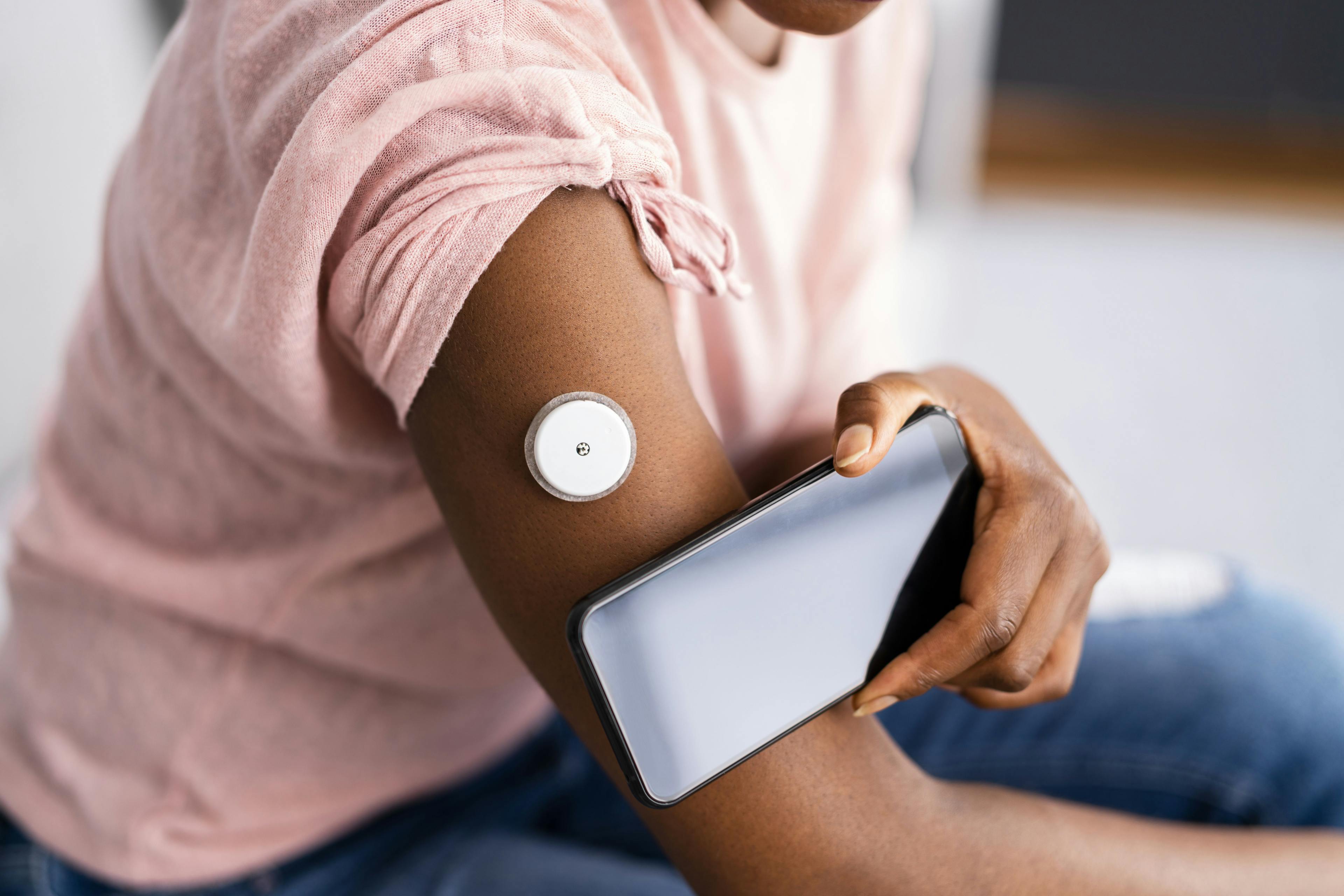 Intermittently Scanned CGM Can Reduce Hypoglycemic Episodes in T1D