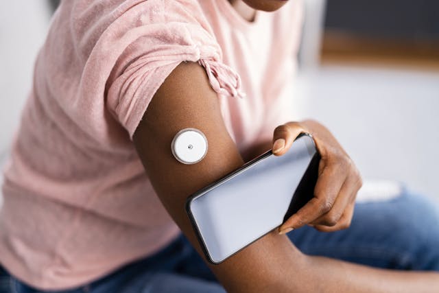 Intermittently Scanned CGM Can Reduce Hypoglycemic Episodes in T1D