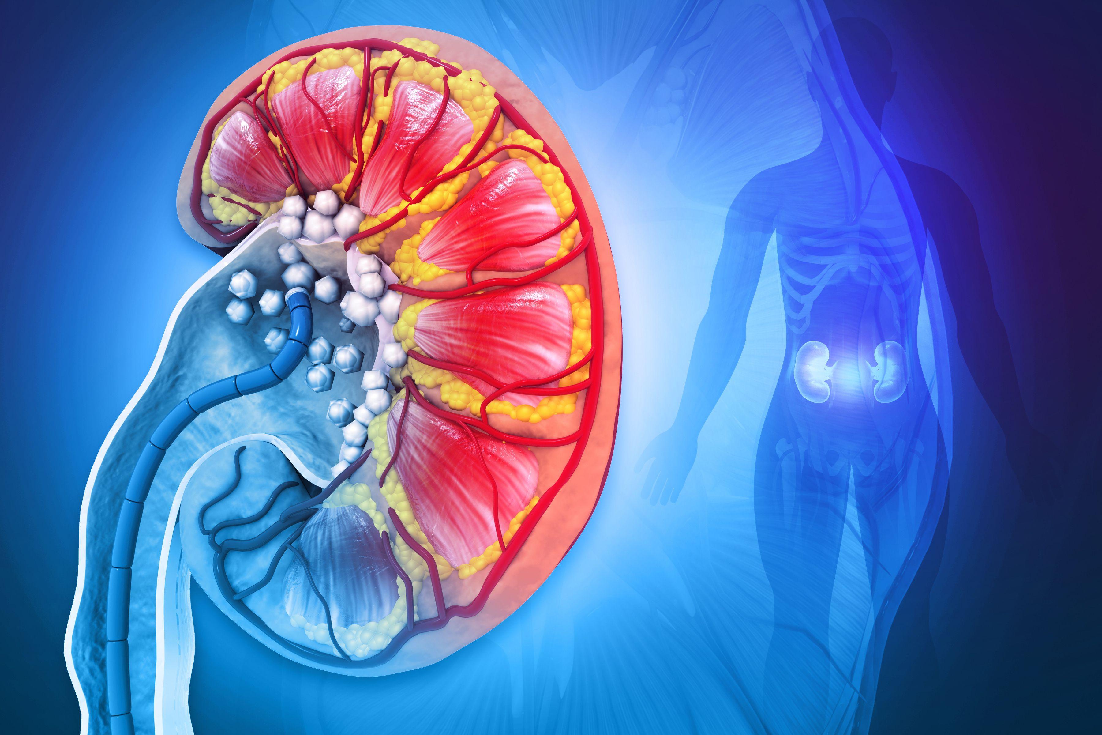 Illustration of kidney stones / Crystal light - stock.adobe.com