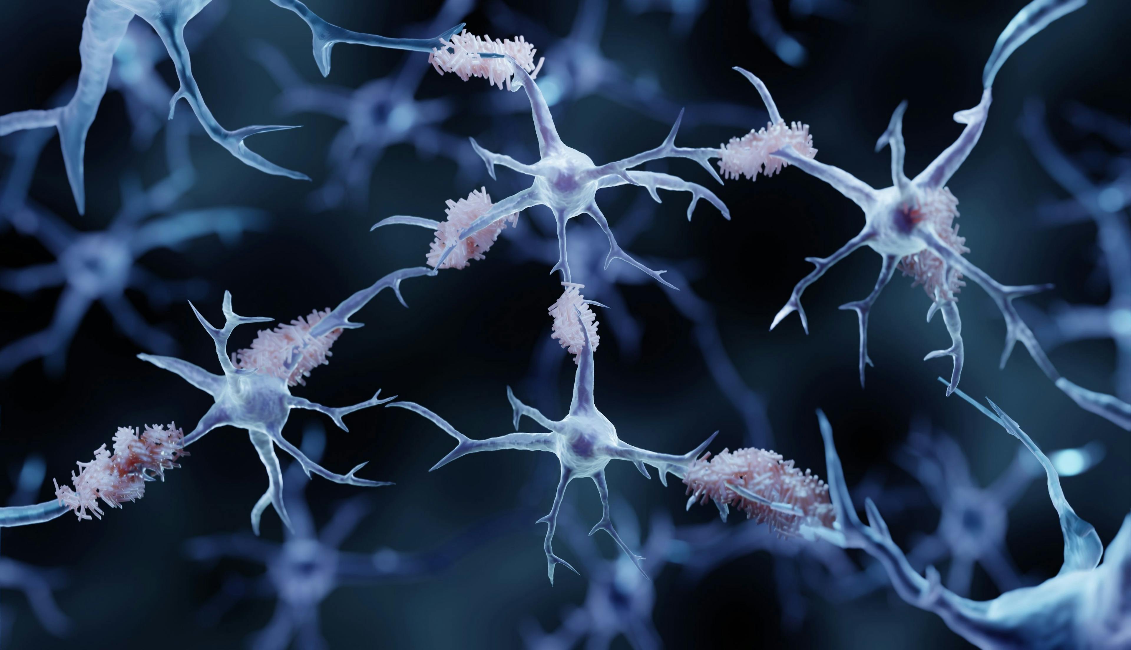 Nearly 7 million Americans are living with Alzheimer disease. | Image credit: Artur - stock.adobe.com