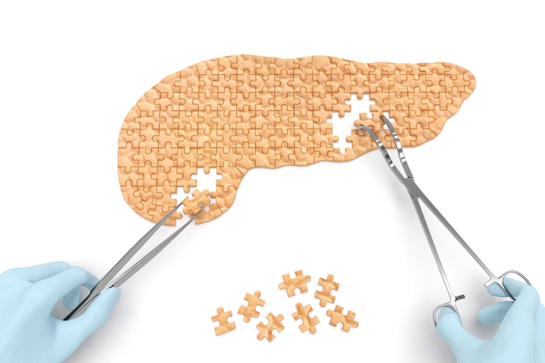 COVID-19 Significantly Impacted Health Services for Patients with Pancreatic Cancer