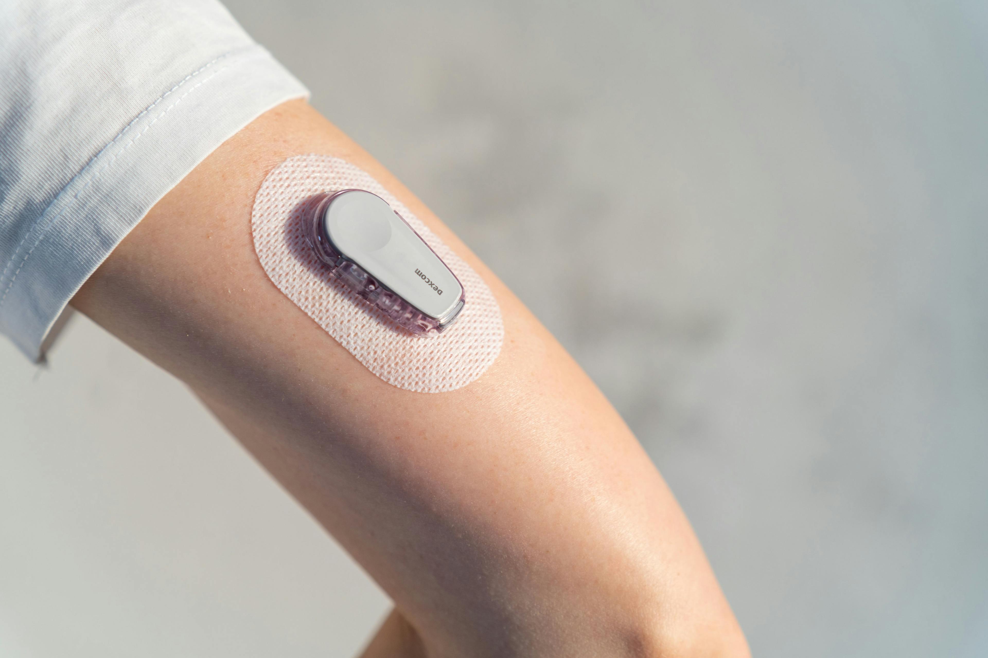 How User Experience Enhances Continuous Glucose Monitoring for Diabetes Management