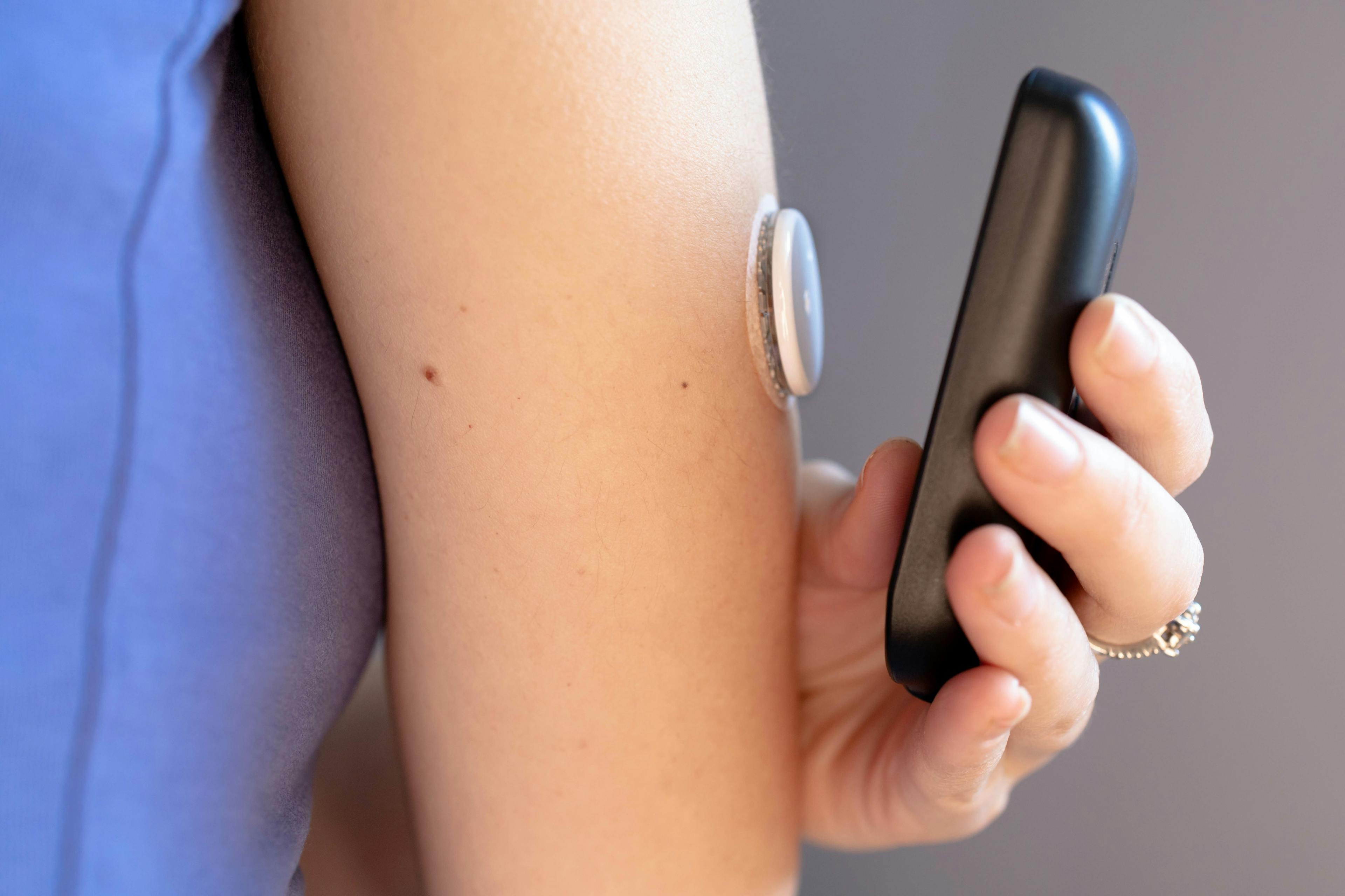 FDA Approves 2 New OTC Continuous Glucose Monitors 