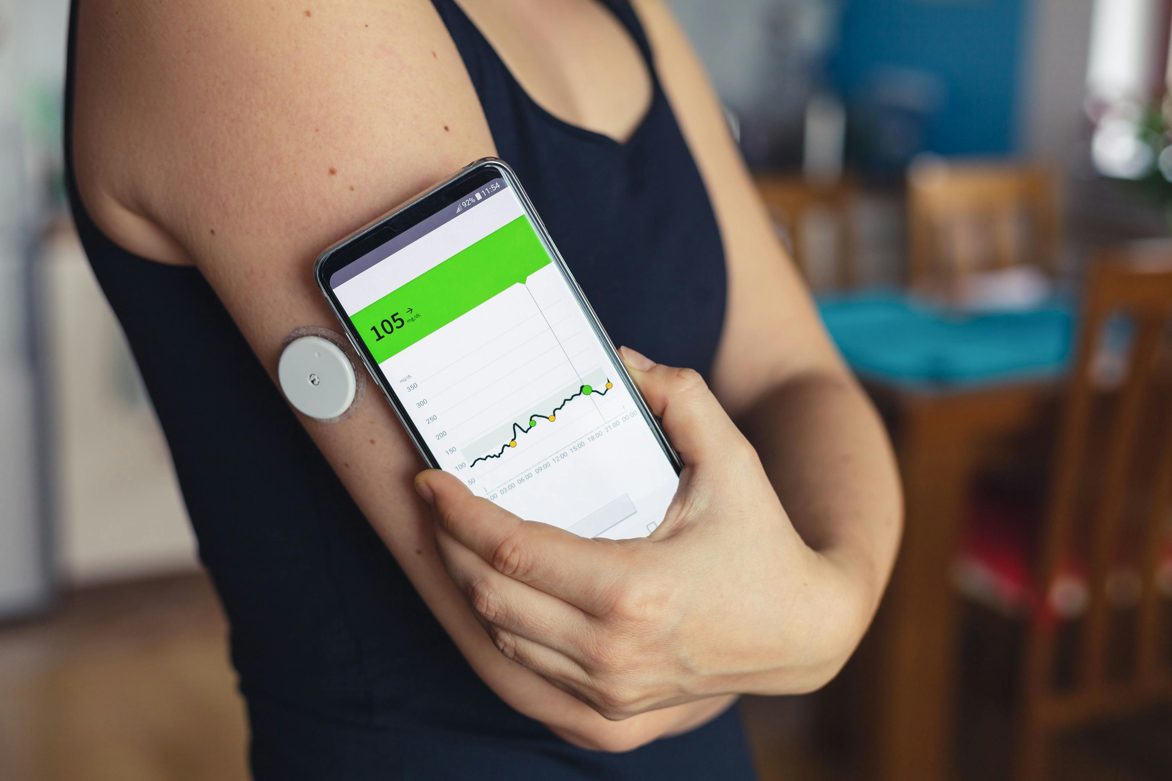 Omnipod 5 FDA Cleared for Use in Adults With Type 2 Diabetes