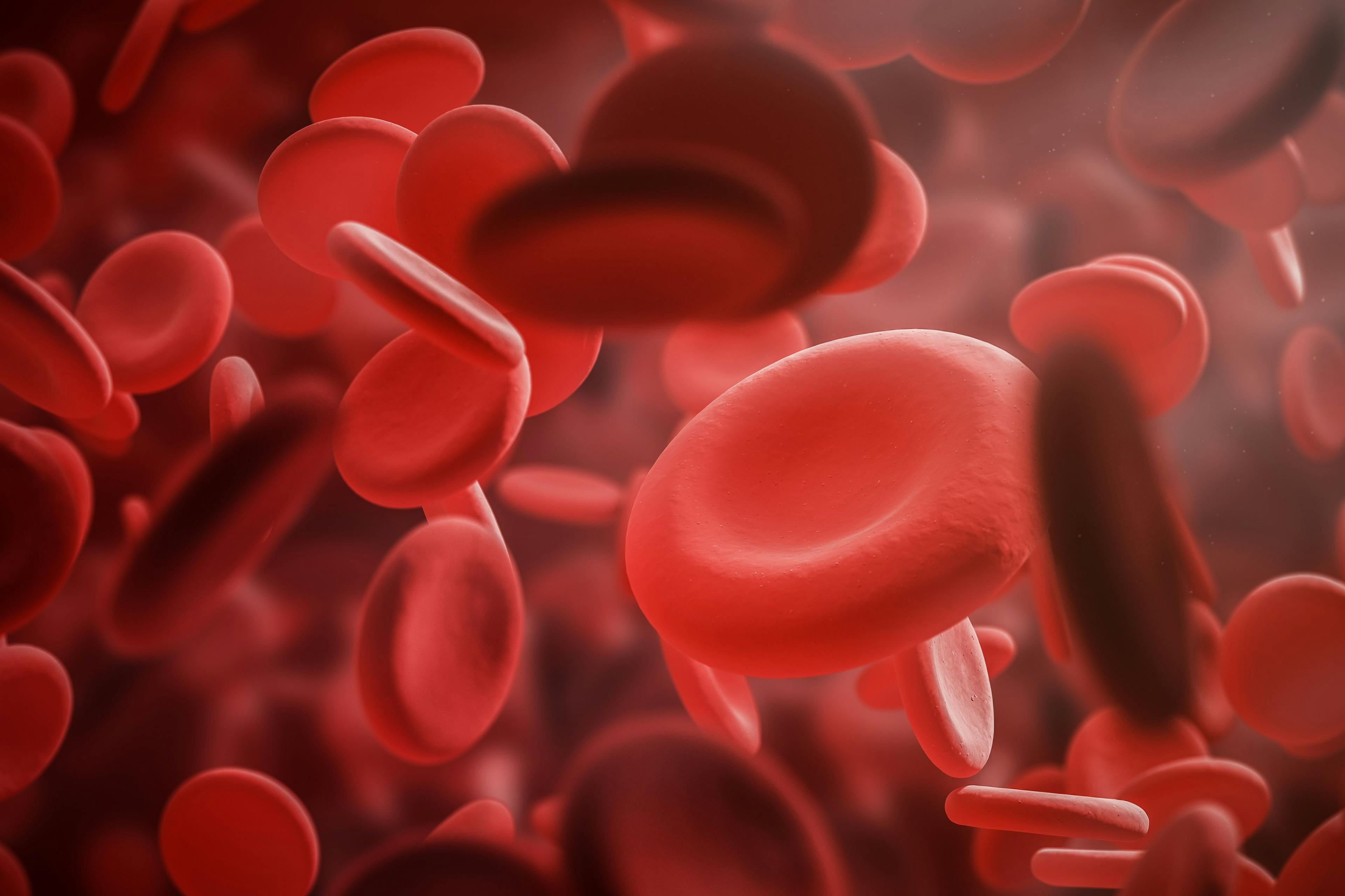 Novel Treatment Is Approved for Myelodysplastic Syndromes With Transfusion-Dependent Anemia