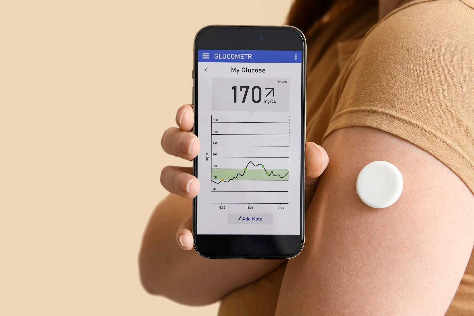Addressing The Need for Better Access to CGM in Low-Income Areas